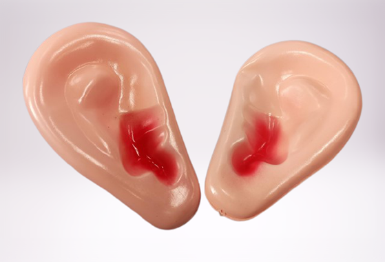 אוזניים ענקיות : image 1 אוזניים ענקיות : image 1